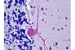 Anti-OSBPL1A / ORP1 antibody IHC of human brain, cerebellum. (OSBPL1A antibody  (AA 938-950))