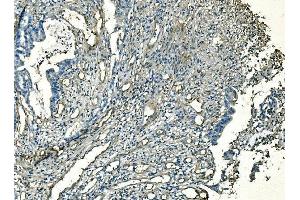 IHC analysis of CD59 using anti-CD59 antibody (ABIN7600941). (CD59 antibody  (AA 26-102))
