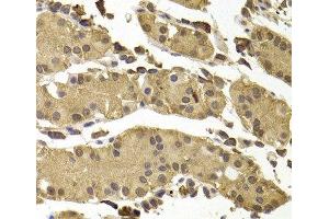 Immunohistochemistry of paraffin-embedded Human stomach using SETD5 Polyclonal Antibody at dilution of 1:100 (40x lens). (SETD5 antibody)