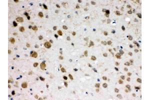 ABR was detected in paraffin-embedded sections of mouse brain tissues using rabbit anti- ABR Antigen Affinity purified polyclonal antibody (Catalog # ) at 1 µg/mL. (ABR antibody  (Middle Region))