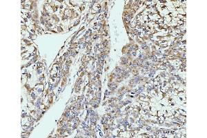IHC analysis of GIT1 using anti-GIT1 antibody (ABIN7601683). (GIT1 antibody  (AA 415-736))