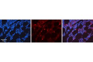 Rabbit Anti-CDK6 Antibody  AV Formalin Fixed Paraffin Embedded Tissue: Human Bone Marrow Tissue Observed Staining: Cytoplasm, Nucleus Primary Antibody Concentration: 1:100 Other Working Concentrations: N/A Secondary Antibody: Donkey anti-Rabbit-Cy3 Secondary Antibody Concentration: 1:200 Magnification: 20X Exposure Time: 0. (CDK6 antibody  (C-Term))