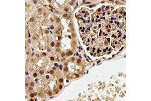 Immunohistochemical analysis of ALG-2 staining in rat kidney formalin fixed paraffin embedded tissue section. (ALG2 antibody)