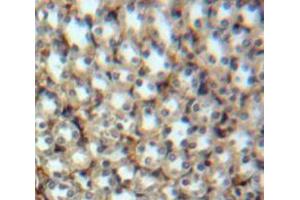 Used in DAB staining on fromalin fixed paraffin-embedded Kidney tissue (High Temperature Requirement Factor A1 (AA 204-364) antibody)