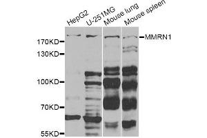 Western blot analysis of extracts of various cell lines, using MMRN1 Antibody (ABIN2563895) at 1:1000 dilution. (Multimerin 1 antibody)