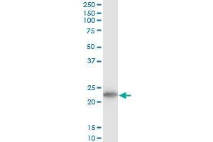 TPT1 monoclonal antibody (M03), clone 2C4. (TPT1 antibody  (AA 35-138))