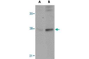 Western blot analysis of GOLPH3 in rat lung tissue lysate with GOLPH3 polyclonal antibody  at (A) 0. (GOLPH3 antibody  (N-Term))