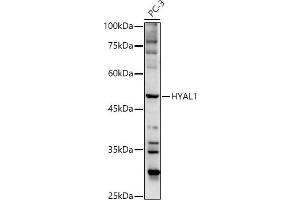 Western blot analysis of extracts of PC-3 cells, using HY antibody  at 1:500 dilution. (HYAL1 antibody  (AA 136-435))