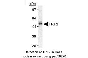 Image no. 1 for anti-Telomeric Repeat Binding Factor 2 (TERF2) antibody (ABIN363585) (TRF2 antibody)