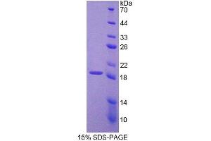 Image no. 1 for Protocadherin 20 (PCDH20) (AA 64-209) protein (His tag) (ABIN4990162)