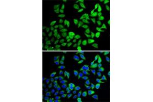 Immunofluorescence analysis of A-549 cells using USP8 antibody (ABIN6132776, ABIN6150035, ABIN6150036 and ABIN6222811). (USP8 antibody  (AA 1-270))