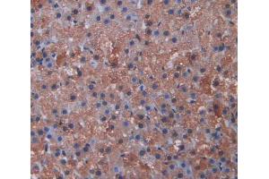 Used in DAB staining on fromalin fixed paraffin- embedded Kidney tissue (CYP11A1 antibody  (AA 392-521))