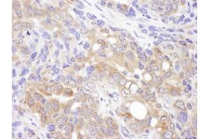 Immunohistochemistry (IHC) image for anti-Valosin Containing Protein (p97)/p47 Complex Interacting Protein 1 (Vcpip1) (AA 1100-1150) antibody (ABIN7453810)
