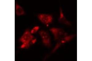 ABIN6276573 staining RAW264. (PYCARD antibody  (N-Term))