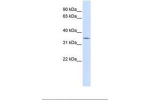 MARCH5 antibody  (C-Term)