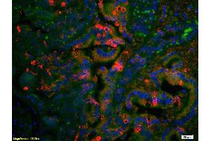 Formalin-fixed and paraffin embedded rat colon tissue labeled with Anti AT2R/AT1 Polyclonal Antibody, Unconjugated (ABIN668616) at 1:200 followed by secondary antibody was Goat Anti-Rabbit IgG, Cy3 conjugated  used at 1:200 dilution for 40 minutes at 37 °C. (Angiotensin II Type 2 Receptor antibody)