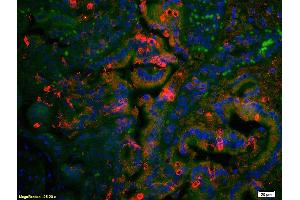 Formalin-fixed and paraffin embedded rat colon tissue labeled with Anti AT2R/AT1 Polyclonal Antibody, Unconjugated (ABIN668616) at 1:200 followed by secondary antibody was Goat Anti-Rabbit IgG, Cy3 conjugated  used at 1:200 dilution for 40 minutes at 37 °C. (Angiotensin II Type 2 Receptor antibody)