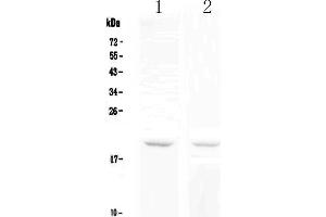 Western blot analysis of BCMA using anti-BCMA antibody . (BCMA antibody  (AA 1-54))