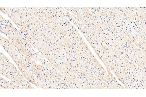 Detection of LEP in Human Cardiac Muscle Tissue using Polyclonal Antibody to Leptin (LEP) (Leptin antibody  (AA 22-167))
