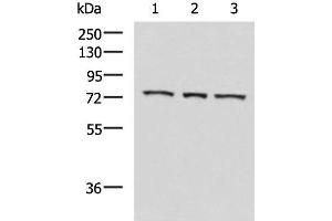 Western blot analysis of K562 cell Mouse heart tissue Jurkat cell lysates using ABI2 Polyclonal Antibody at dilution of 1:550 (ABI2 antibody)