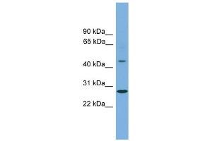 WB Suggested Anti-ZNF514 Antibody Titration:  0. (ZNF514 antibody  (Middle Region))