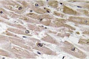 Immunohistochemistry analysisof BMP-2 Antibody in paraffin-embedded human heart tissue. (BMP2 antibody)