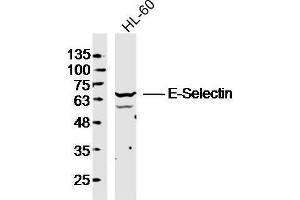 Human HL-60 cells probed with E-selectin Polyclonal Antibody, unconjugated  at 1:300 overnight at 4°C followed by a conjugated secondary antibody at 1:10000 for 90 minutes at 37°C.