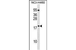 Western blot analysis in NCI-H460 cell line lysates (35ug/lane). (MRPL54 antibody  (AA 64-92))