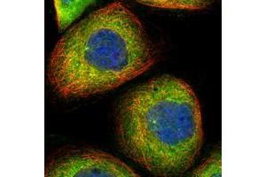 Immunofluorescent staining of human cell line A-431 with DYNC1LI1 polyclonal antibody  at 1-4 ug/mL dilution shows positivity in cytoplasm & centrosome. (DYNC1LI1 antibody)