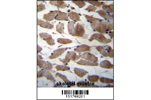 ACTN3 Antibody immunohistochemistry analysis in formalin fixed and paraffin embedded human skeletal muscle followed by peroxidase conjugation of the secondary antibody and DAB staining. (ACTN3 antibody  (AA 409-437))