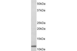 Western Blotting (WB) image for anti-beta-2-Microglobulin (B2M) (N-Term) antibody (ABIN2465099) (beta-2 Microglobulin antibody  (N-Term))