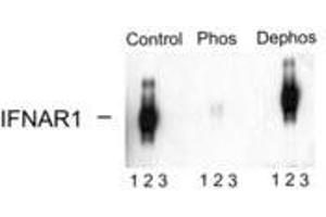 Image no. 1 for anti-Interferon alpha/beta Receptor 1 (IFNAR1) (pSer535), (Ser539) antibody (ABIN228236) (IFNAR1 antibody  (pSer535, Ser539))