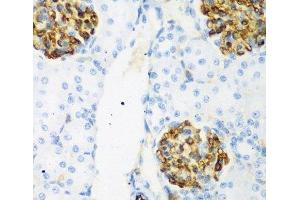 Immunohistochemistry of paraffin-embedded Rat kidney using CSRNP1 Polyclonal Antibody at dilution of 1:200 (40x lens).