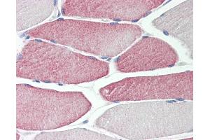 Human Skeletal Muscle: Formalin-Fixed, Paraffin-Embedded (FFPE) (CYP2D6 antibody  (AA 268-457))