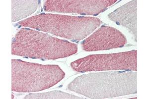 Human Skeletal Muscle: Formalin-Fixed, Paraffin-Embedded (FFPE) (CYP2D6 antibody  (AA 268-457))