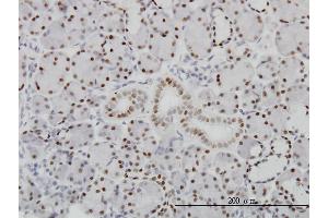 Immunoperoxidase of monoclonal antibody to PBX1 on formalin-fixed paraffin-embedded human salivary gland.