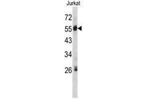 Western Blotting (WB) image for anti-Serpin Peptidase Inhibitor, Clade G (C1 Inhibitor), Member 1 (SERPING1) (Middle Region) antibody (ABIN453369)
