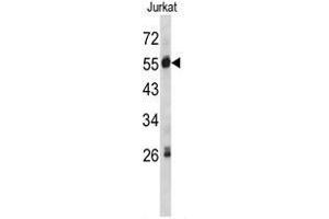 Western blot analysis of SERPING1 antibody (Center) in Jurkat cell line lysates (35ug/lane).