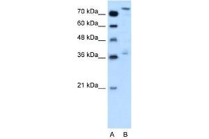 Human HepG2; WB Suggested Anti-NFE2L3 Antibody Titration: 0. (NFE2L3 antibody  (Middle Region))