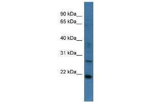 WB Suggested Anti-STARD4 Antibody Titration: 0. (STARD4 antibody  (Middle Region))
