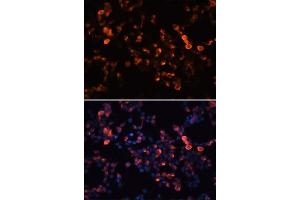 Immunofluorescence analysis of 293T cells using Mouse anti GFP-Tag mAb. (GFP antibody  (AA 1-100))