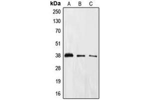 Western blot analysis of EIF2S1 (pS51) expression in HeLa (A), PC12 (B), A431 (C) whole cell lysates. (EIF2S1 antibody  (pSer51))