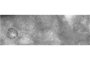Immunoelectron Microscopy (IEM) image for anti-Cathepsin D (CTSD) (C-Term) antibody (ABIN6254162)