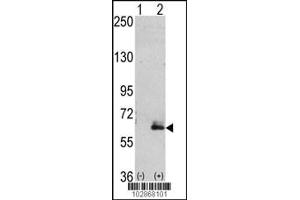 Western blot analysis of hMAP2-Q425 using rabbit polyclonal hMAP2-Q425 Antibody using 293 cell lysates (2 ug/lane) either nontransfected (Lane 1) or transiently transfected with the hMAP2-Q425 gene (Lane 2). (MAP2 antibody  (C-Term))