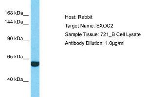 Host: Rabbit Target Name: EXOC2 Sample Type: 721_B Whole Cell lysates Antibody Dilution: 1. (EXOC2 antibody  (N-Term))