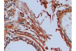 Detection of OCT4 in Human Mammary gland Tissue using Polyclonal Antibody to Octamer Binding Transcription Factor 4 (OCT4) (OCT4 antibody  (AA 136-360))