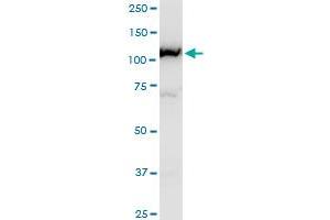 CAND1 polyclonal antibody (A01), Lot # 051005JC01. (CAND1 antibody  (AA 1-100))