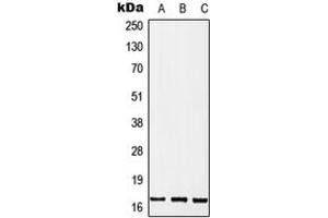Western blot analysis of MGST2 expression in MCF7 (A), SP2/0 (B), PC12 (C) whole cell lysates. (MGST2 antibody  (Center))
