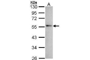 WB Image Sample (30 ug of whole cell lysate) A: A431 , 10% SDS PAGE antibody diluted at 1:1000 (Annexin A11 antibody  (N-Term))