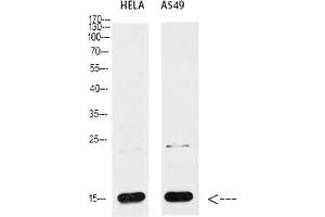 Western blot analysis of Hela (1), A549 (2), diluted at 1:1000.